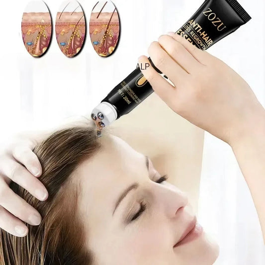 Schnelles Haarwachstumsserum – Effektives Anti-Haarausfall-Serum, Haarausfall-Reparatur, Kräuterpflege nach der Geburt, Seborrhoisches Haarpflegeprodukt
