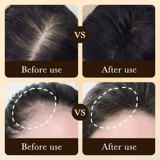 Schnelles Haarwachstumsserum – Effektives Anti-Haarausfall-Serum, Haarausfall-Reparatur, Kräuterpflege nach der Geburt, Seborrhoisches Haarpflegeprodukt